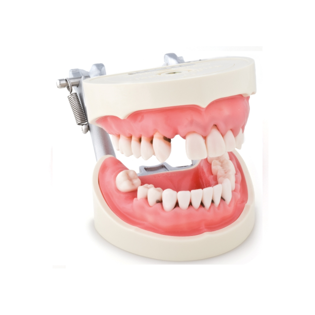 Model do nauki periodontologii