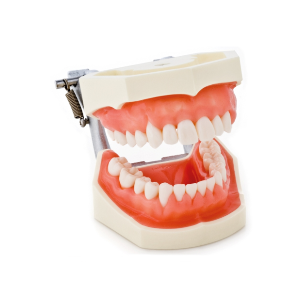Model periodontologiczny z recesją wyrostka zębodołowego