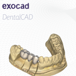 exocad DentalCAD